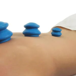 Cupping set gumeni plavi - 4 komada