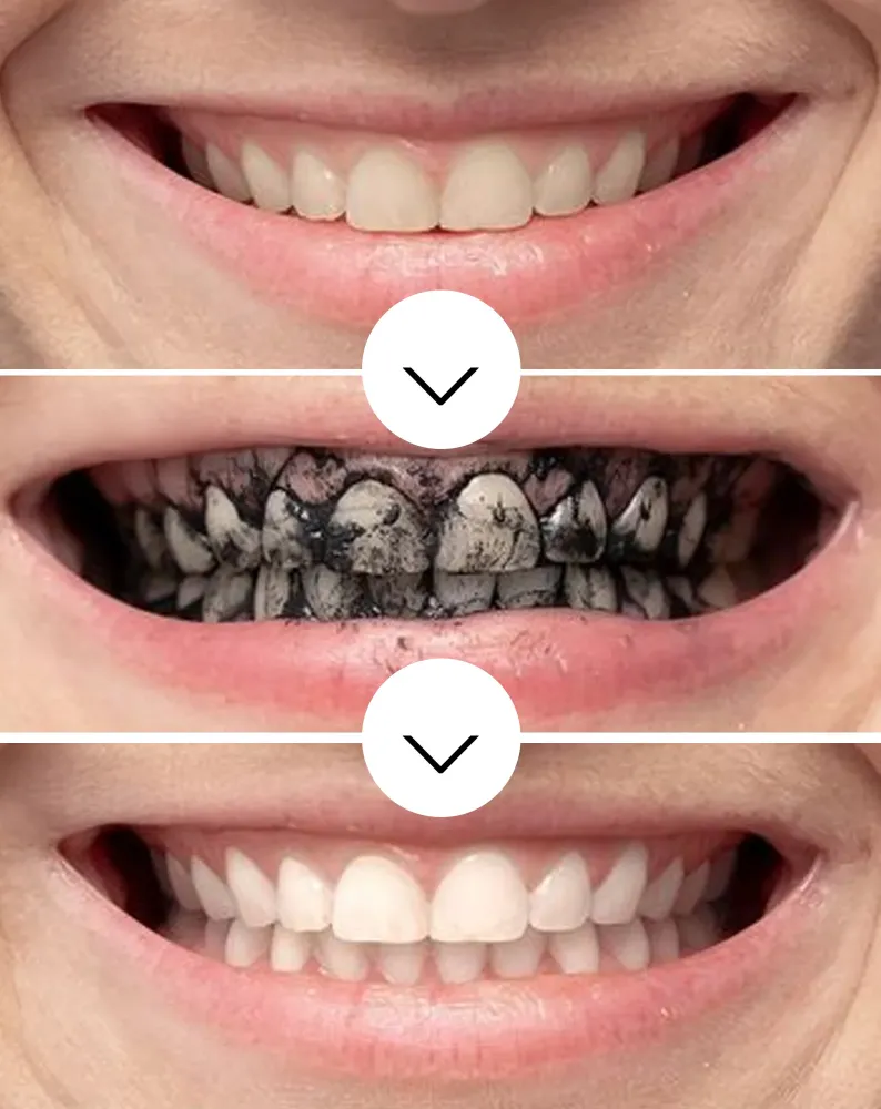Prah za izbjeljivanje zubi od kokosovog ugljena Smilebite